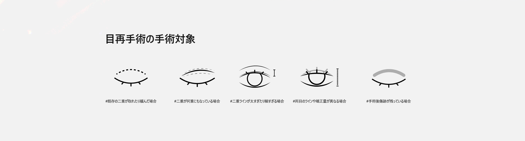 [目再手術の手術対象] #既存の二重が取れたり緩んだ場合 #二重が何重にもなっている場合 #二重ラインが太すぎたり細すぎる場合 #両目のラインや矯正量が異なる場合 #手術後傷跡が残っている場合 