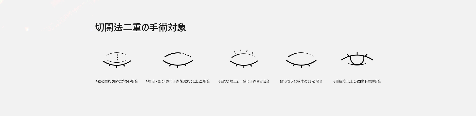 [切開法二重の手術対象] #瞼の垂れや脂肪が多い場合 #埋没 / 部分切開手術後取れてしまった場合 #目つき矯正と一緒に手術する場合 #鮮明なラインを求めている場合 #重症度以上の眼瞼下垂の場合 