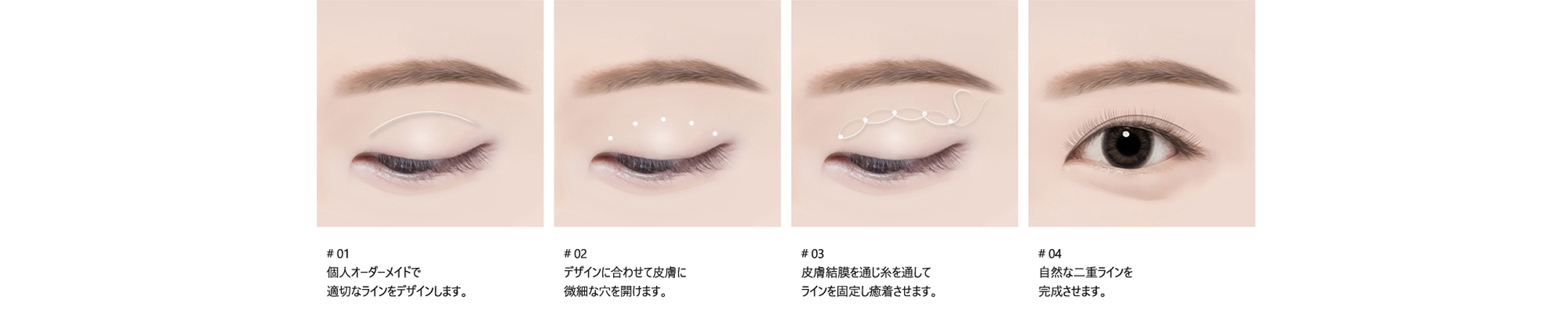 # 01 : 個人オーダーメイドで 適切なラインをデザインします。/ # 02 : デザインに合わせて皮膚に微細な穴を開けます。 / # 03 : 皮膚結膜を通じ糸を通してラインを固定し癒着させます。 / # 04 : 自然な二重ラインを完成させます。