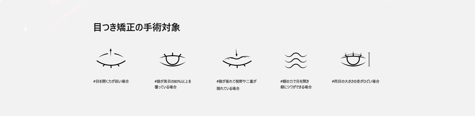 [目つき矯正の手術対象#目を開く力が弱い場合 #瞼が黒目の80%以上を覆っている場合 #瞼が垂れて視野や二重が隠れている場合 #額の力で目を開き額にシワができる場合 #両目の大きさの差がひどい場合 ]