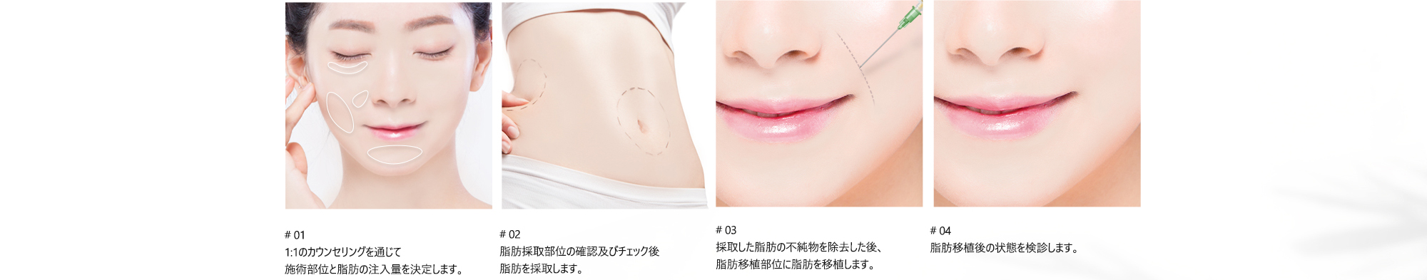 # 01 : 1:1のカウンセリングを通じて施術部位と脂肪の注入量を決定します。/ # 02 : 脂肪採取部位の確認及びチェック後脂肪を採取します。/ # 03 : 採取した脂肪の不純物を除去した後、脂肪移植部位に脂肪を移植します。/ # 04 : 脂肪移植後の状態を検診します。