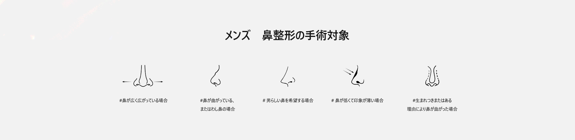 [メンズ　鼻整形の手術対象] #鼻が広く広がっている場合  #鼻が曲がっている、またはわし鼻の場合  ＃男らしい鼻を希望する場合  # 鼻が低くて印象が薄い場合  #生まれつきまたはある理由により鼻が曲がった場合