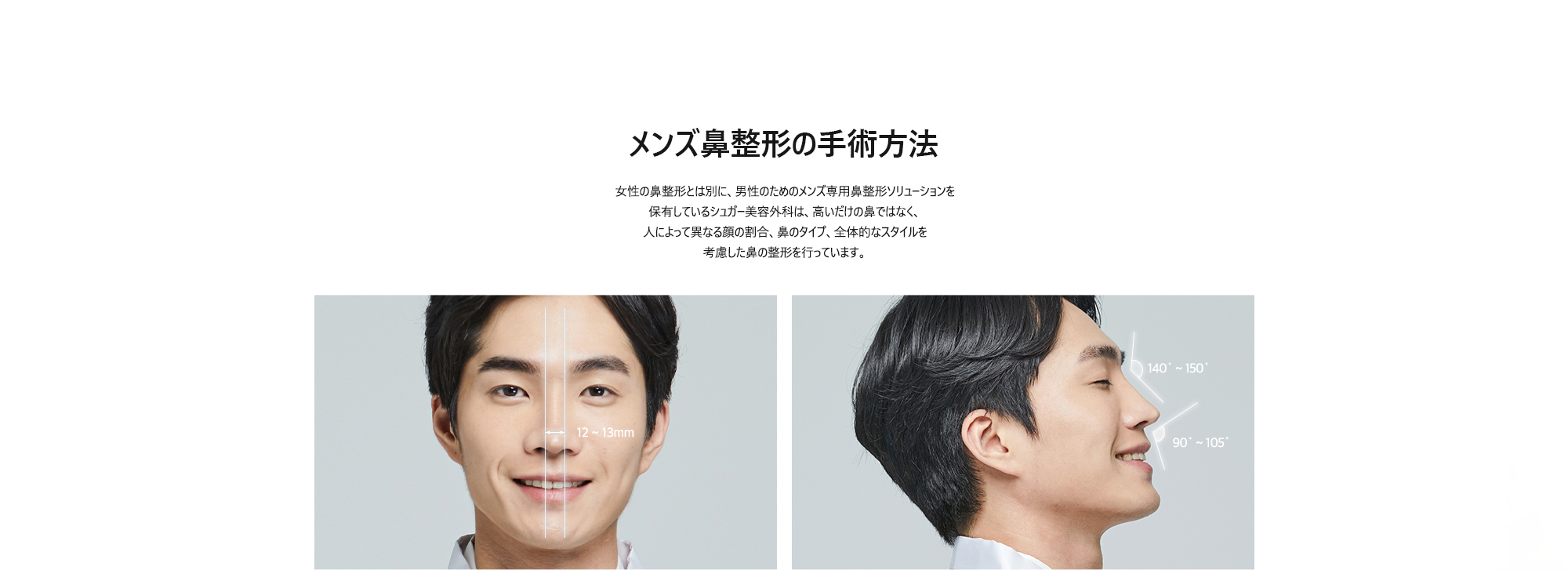 [メンズ鼻整形の手術方法] 女性の鼻整形とは別に、男性のためのメンズ専用鼻整形ソリューションを保有しているシュガー美容外科は、高いだけの鼻ではなく、人によって異なる顔の割合、鼻のタイプ、全体的なスタイルを考慮した鼻の整形を行っています。