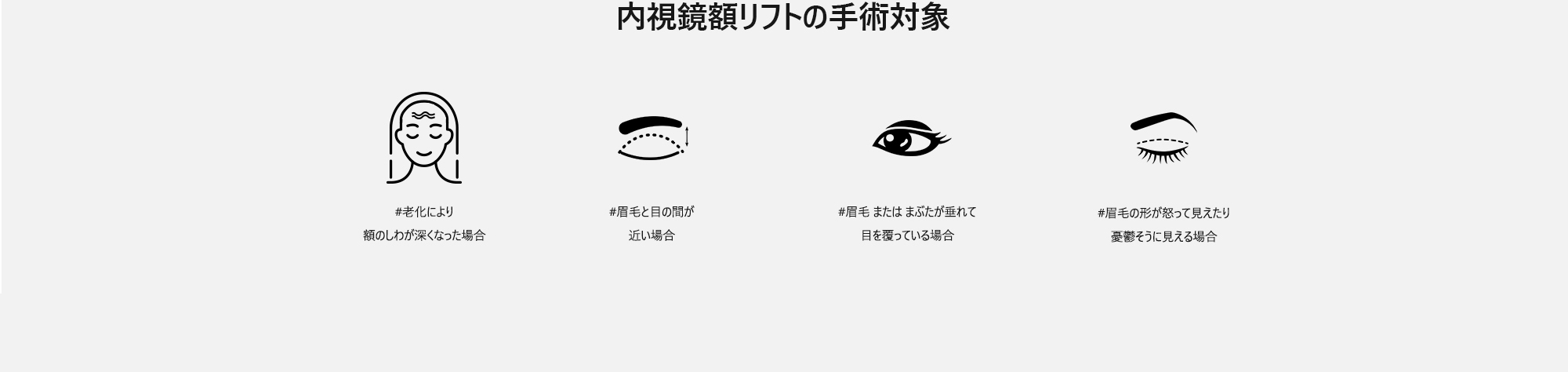 [内視鏡額リフトの手術対象] #老化により額のしわが深くなった場合  #眉毛と目の間が近い場合  #眉毛 または まぶたが垂れて目を覆っている場合  #眉毛の形が怒って見えたり憂鬱そうに見える場合