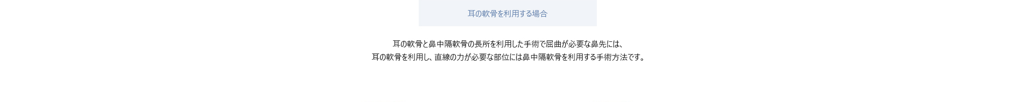 [耳の軟骨を利用する場合] 耳の軟骨と鼻中隔軟骨の長所を利用した手術で屈曲が必要な鼻先には、耳の軟骨を利用し、直線の力が必要な部位には鼻中隔軟骨を利用する手術方法です。