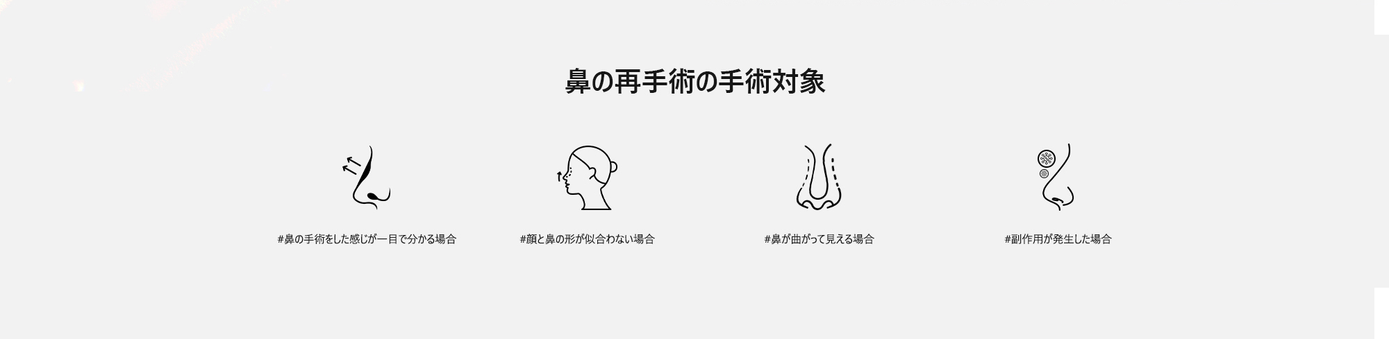 [鼻の再手術の手術対象] #鼻の手術をした感じが一目で分かる場合  #顔と鼻の形が似合わない場合  #鼻が曲がって見える場合  #副作用が発生した場合