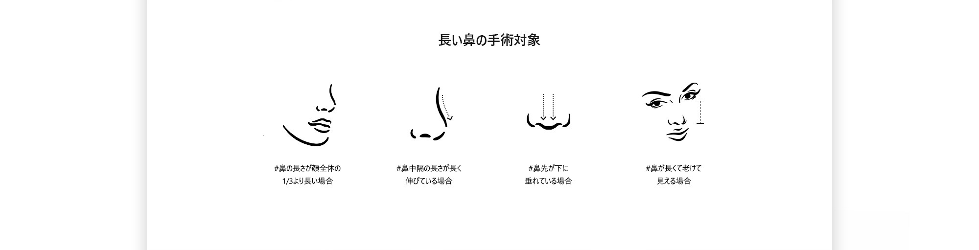 [長い鼻の手術対象] #鼻の長さが顔全体の1/3より長い場合  #鼻中隔の長さが長く伸びている場合  #鼻先が下に垂れている場合  #鼻が長くて老けて見える場合