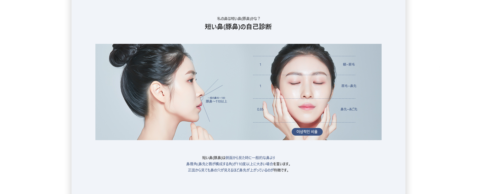 [私の鼻は短い鼻(豚鼻)かな？ 短い鼻(豚鼻)の自己診断] 短い鼻(豚鼻)は側面から見た時に一般的な鼻より鼻唇角(鼻先と唇が構成する角)が110度以上に大きい場合を言います。正面から見ても鼻の穴が見えるほど鼻先が上がっているのが特徴です。