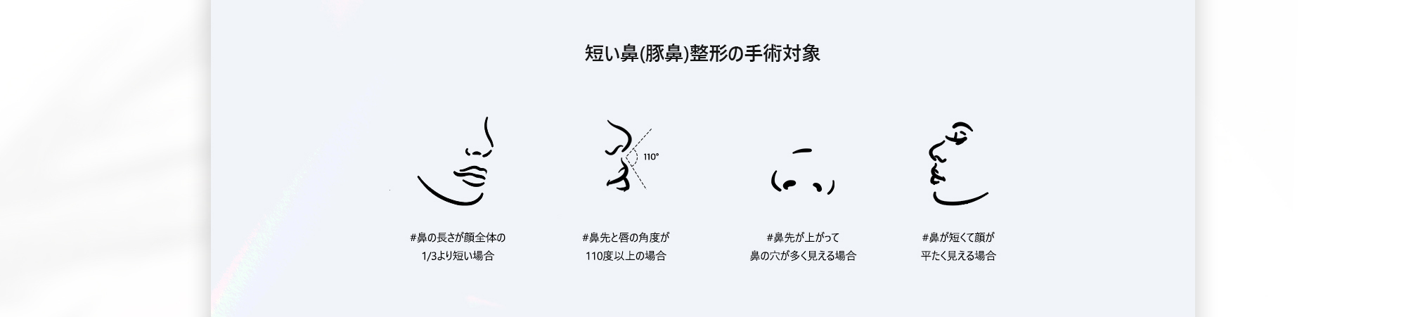 [短い鼻(豚鼻)整形の手術対象] #鼻の長さが顔全体の1/3より短い場合  #鼻先と唇の角度が110度以上の場合  #鼻先が上がって鼻の穴が多く見える場合  #鼻が短くて顔が平たく見える場合