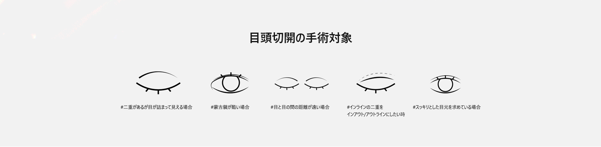 [目頭切開の手術対象] #二重があるが目が詰まって見える場合 #蒙古襞が酷い場合 #目と目の間の距離が遠い場合 #インラインの二重をインアウト/アウトラインにしたい時 #スッキリとした目元を求めている場合