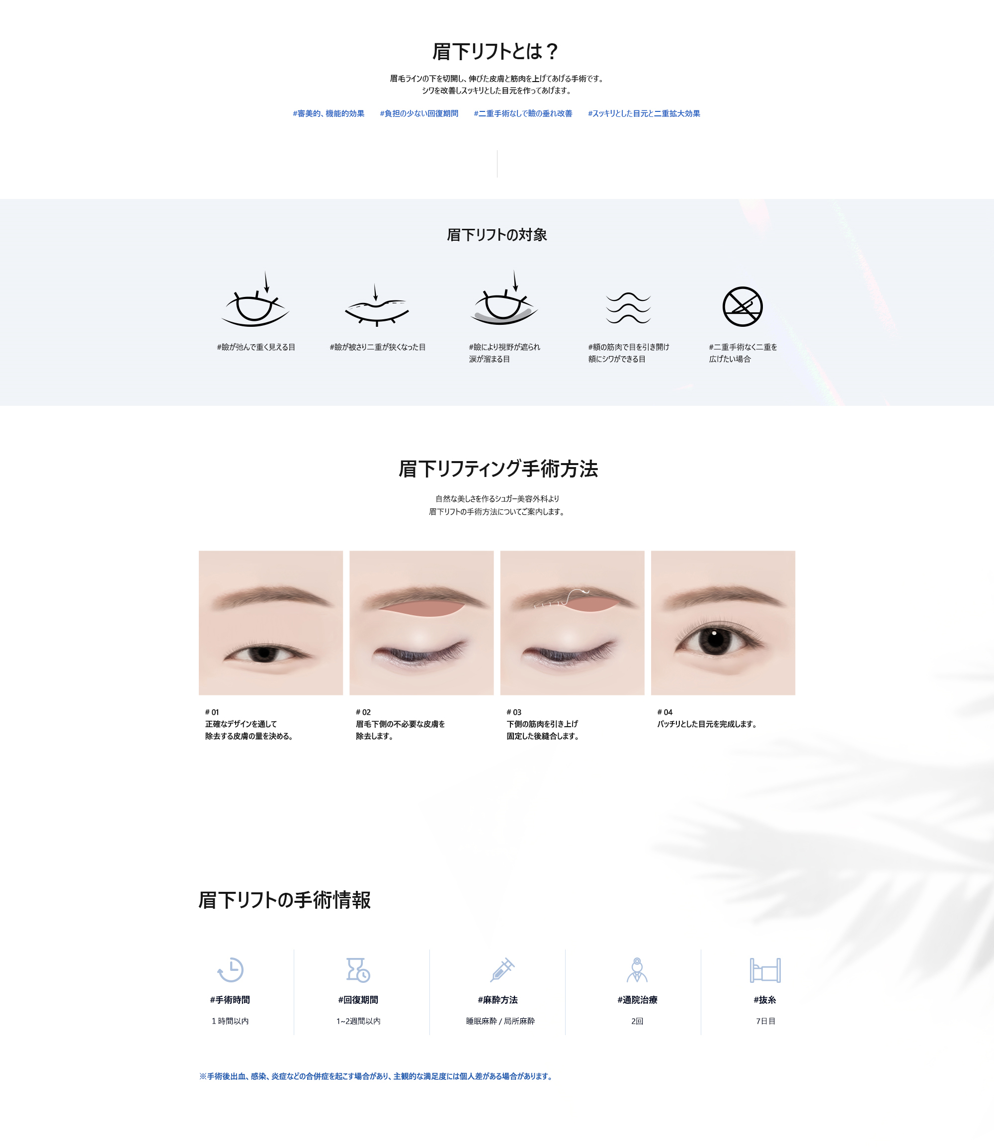 # 눈썹하거상