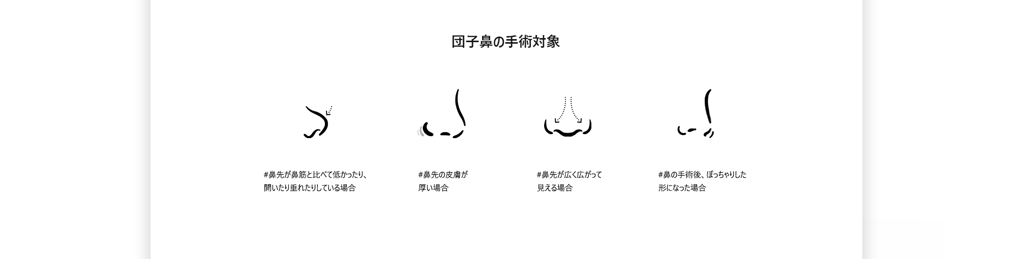 복코 수술대상