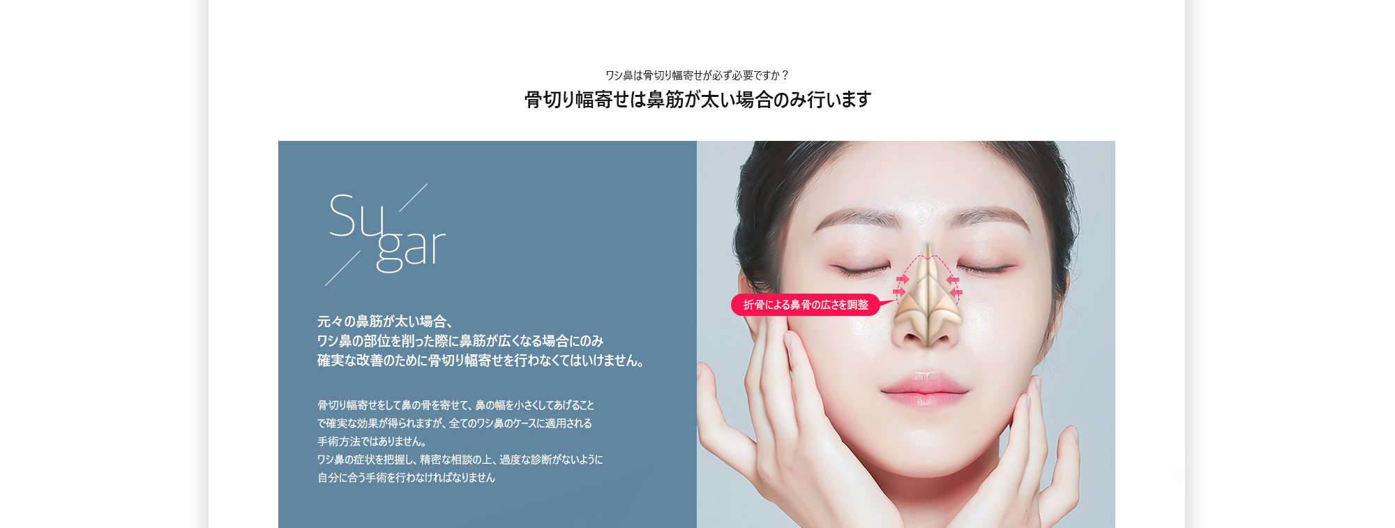 매부리코는 절골에 반드시 필요한가요?